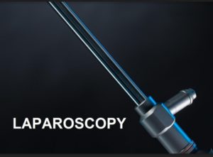LAPROSCOPY, NỘI SOI PHẪU THUẬT Ổ BỤNG